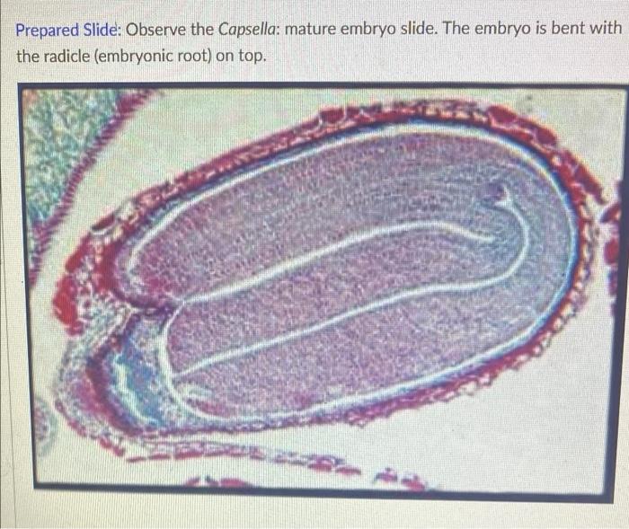 Prepared Slide Observe The Capsella Mature Embryo Slide The Embryo Is Bent With The Radicle Embryonic Root On Top 1