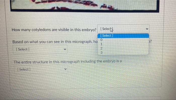 Prepared Slide Observe The Capsella Mature Embryo Slide The Embryo Is Bent With The Radicle Embryonic Root On Top 2