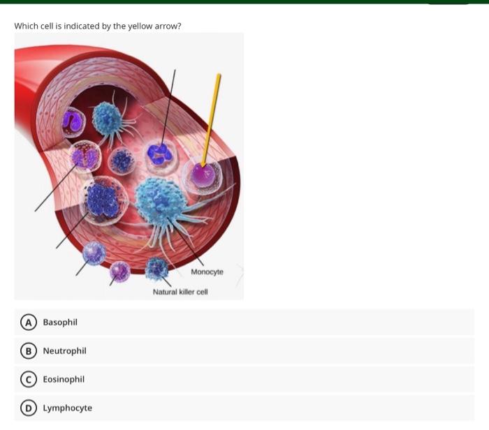 Question 1 After Losing Blood Karen Needs A Blood Transfusion Her Blood Is O Which Donor Blood Is Compatible A Ab 3
