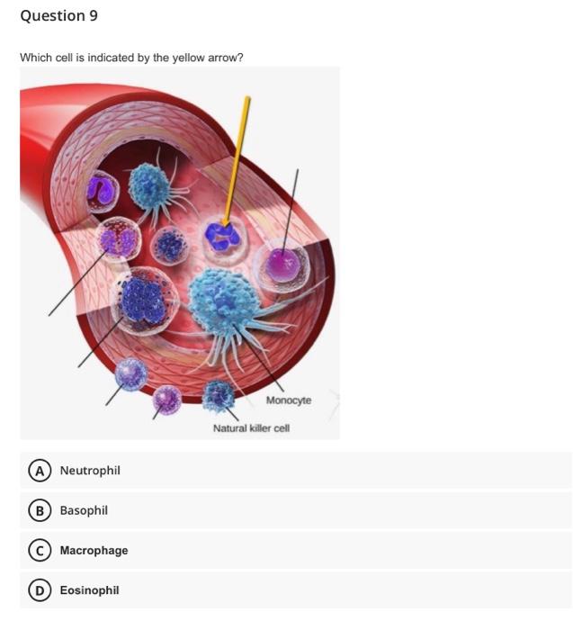 Question 1 After Losing Blood Karen Needs A Blood Transfusion Her Blood Is O Which Donor Blood Is Compatible A Ab 8
