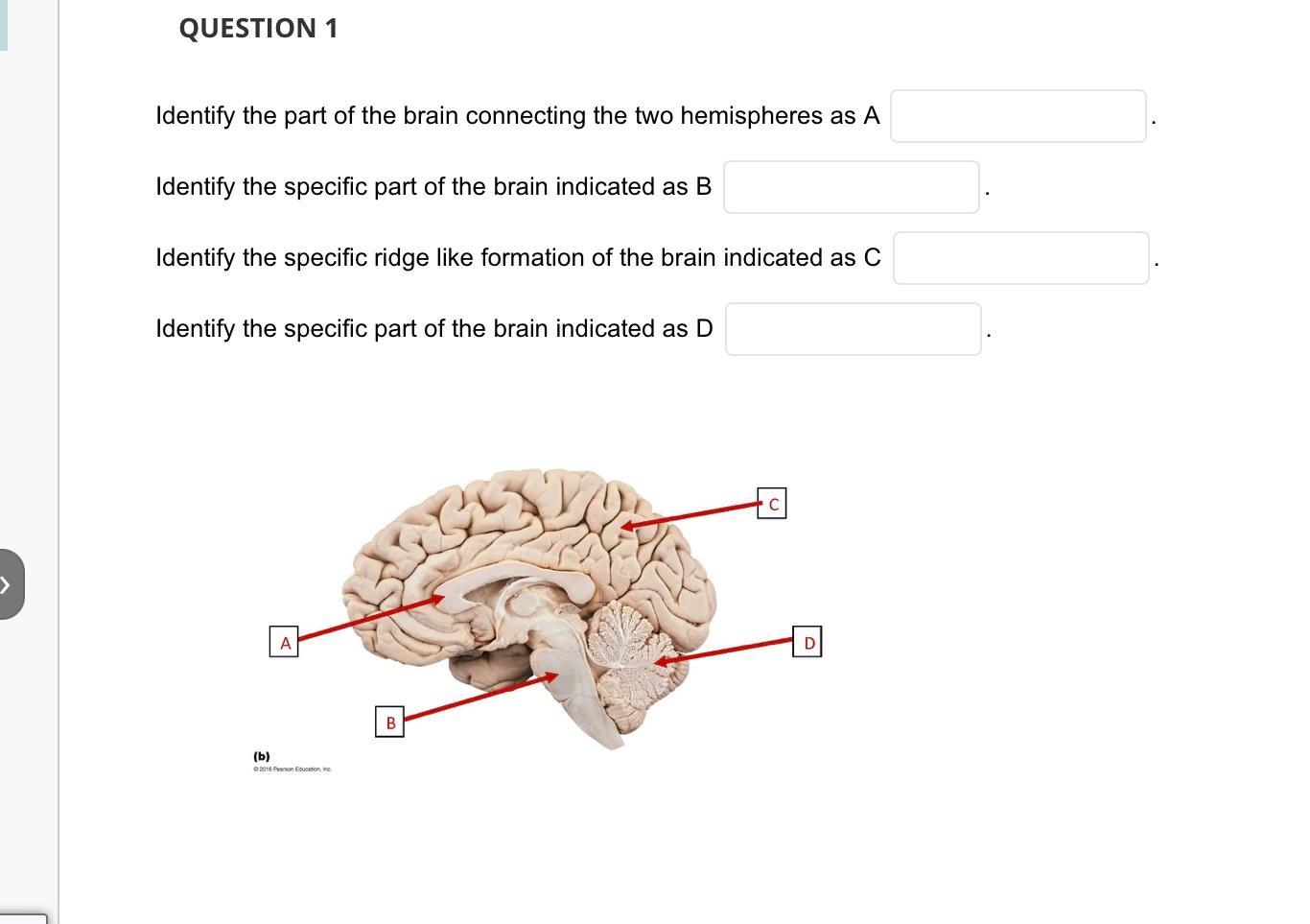 Question 1 Identify The Part Of The Brain Connecting The Two Hemispheres As A Identify The Specific Part Of The Brain In 1