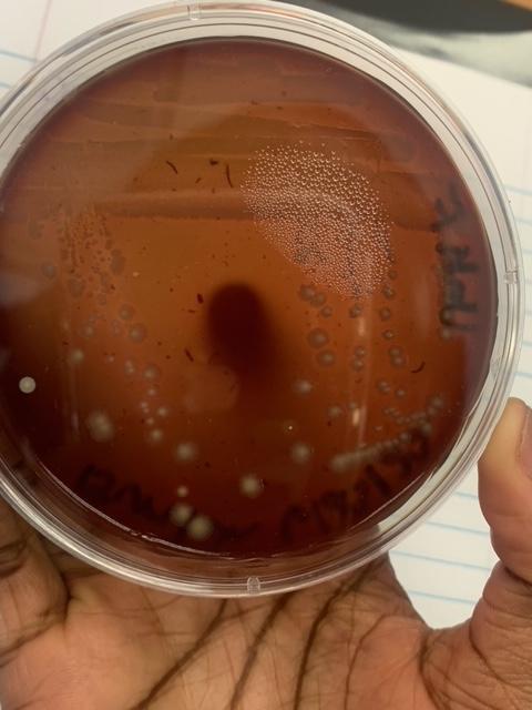 Please Help Me To Identify The Unknown By The Gram Stains Of Emb Agar Nutrient Agar Blood Agar And Also By A Broth Wh 1