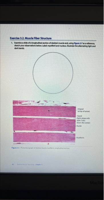 Exercise 3 2 Muscle Fiber Structure 1 Damine A Side Of A Longitudinal Section Of Skeletal Muscle And Using Figure 3 7 1