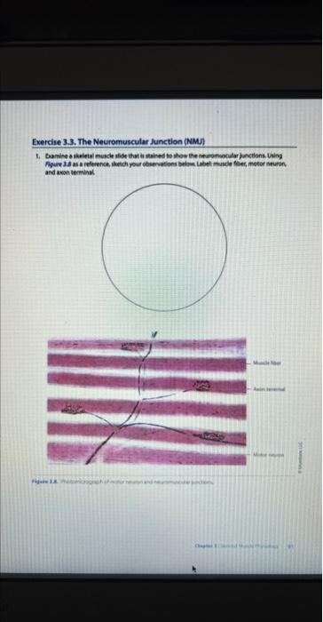 Exercise 3 3 The Neuromuscular Junction Nmj 1 Dxamine A Skeletal Muscle Side That Is Stained To Show Neuromuscular J 1