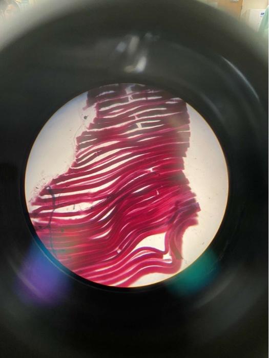 Exercise 3 3 The Neuromuscular Junction Nmj 1 Dxamine A Skeletal Muscle Side That Is Stained To Show Neuromuscular J 2