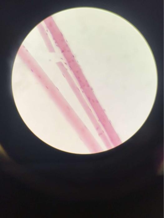 Exercise 3 2 Muscle Fiber Structure 1 Examine A Slide Of A Longitudinal Section Of Skeletal Muscle And Using Figure 3 2