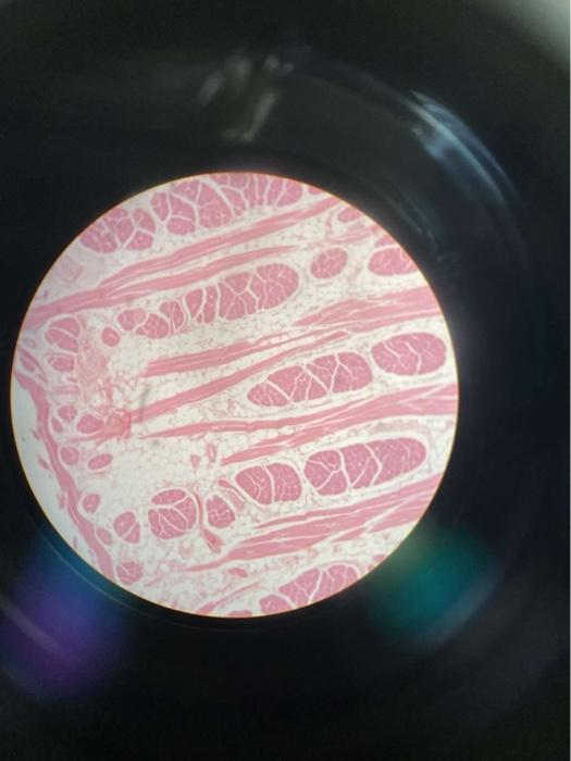Lab Exercises Exercise 3 1 Muscle Organization 1 Examine A Prepared Slide Of A Cross Section Of Skeletal Muscle Using 1