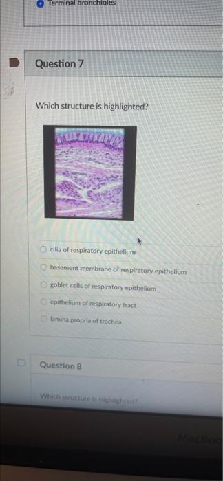 Question 7 Terminal Bronchioles Which Structure Is Highlighted O O Cilia Of Respiratory Epithelium Basement Membrane Of 1