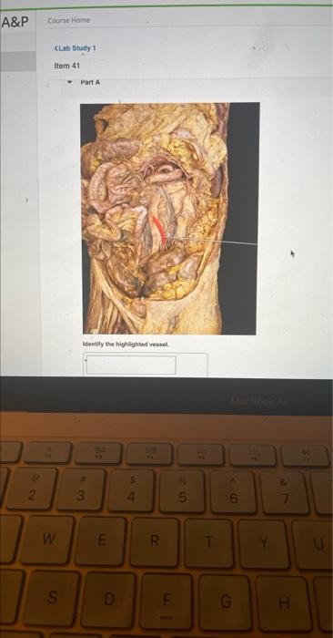 A P 22 Course Home Clab Study 1 Item 41 W S Part A Identify The Highlighted Vessel W3 550 E D 4 102 R F 25 T 6 G Y 1