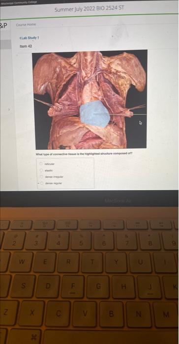 Bp N Course Home P Clab Study 1 Item 42 M S What Type Of Connective Is Highlighted Structure Composed Of 3 X 30 Watc D 1