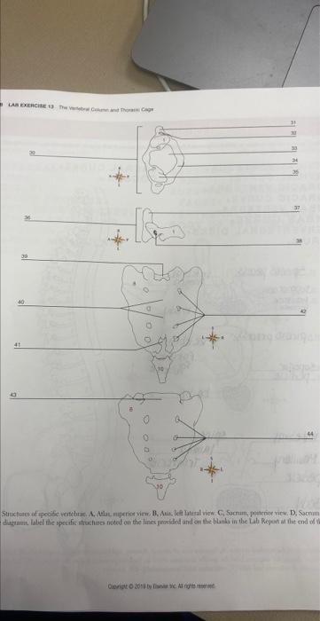 Lab Exercise 13 The Verbal And The 43 40 O D 10 35 Structures Of Specific Vertebrae A Atlas Niperior View B Atis L 1