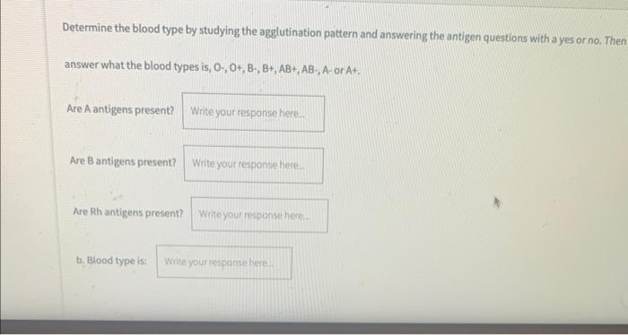 Determine The Blood Type By Studying The Agglutination Pattern And Answering The Antigen Questions With A Yes Or No The 1