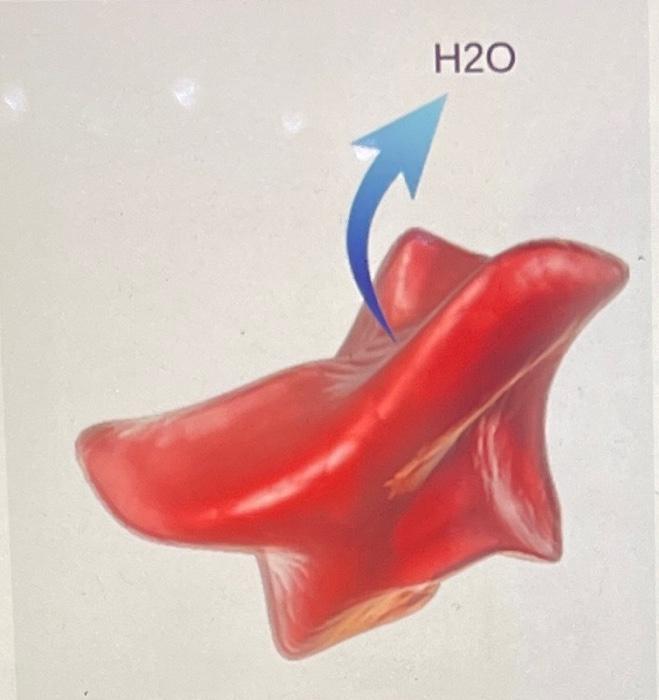 1 The Red Blood Cell Shown Here Is Losing Water To Its External Environment Which Type Of Solution Would Cause This Ty 1