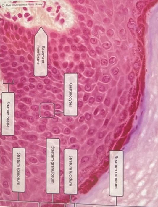 1 The Red Blood Cell Shown Here Is Losing Water To Its External Environment Which Type Of Solution Would Cause This Ty 4