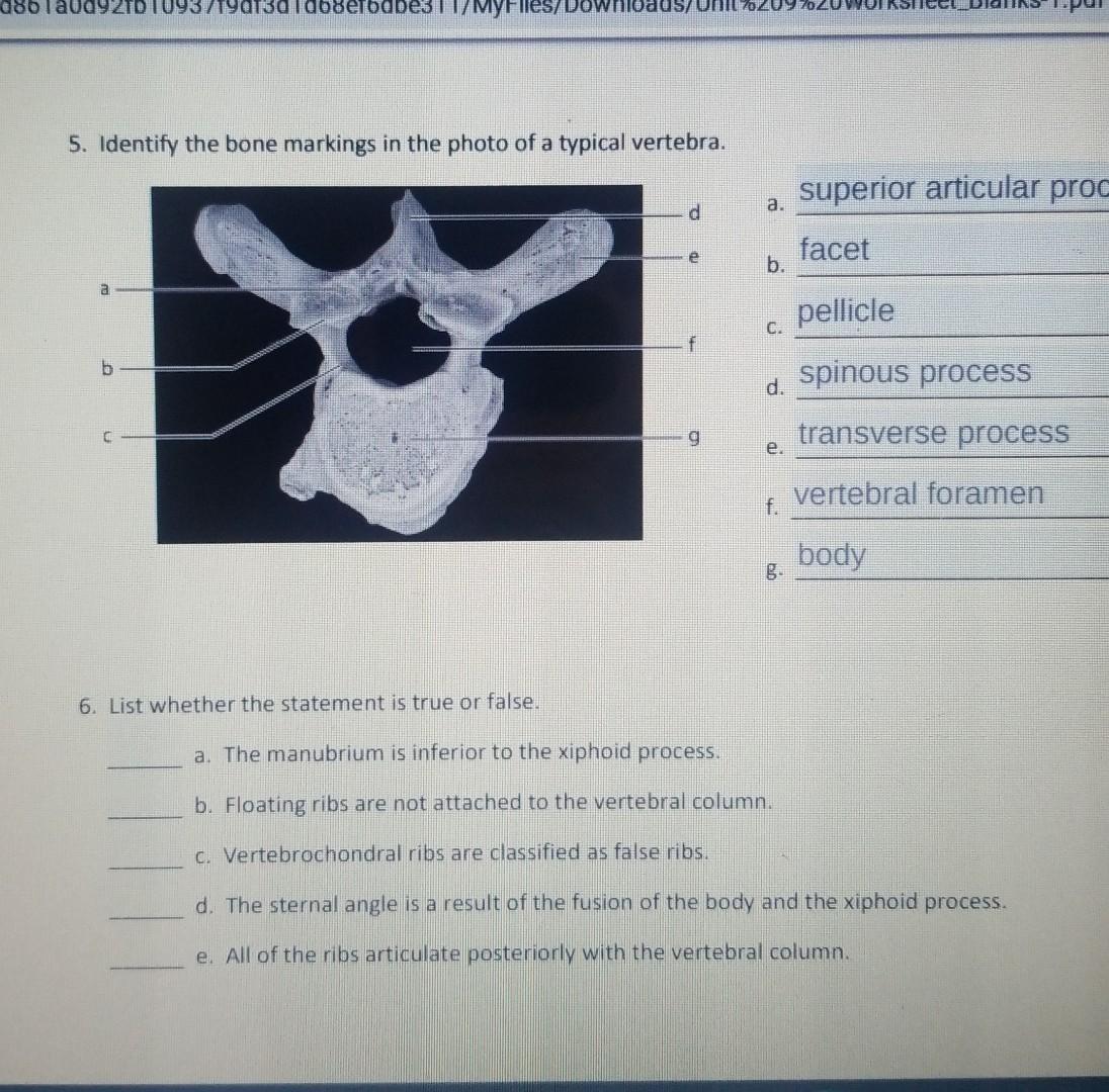 086120092td 1093 1903d1d68efdbes 5 Identify The Bone Markings In The Photo Of A Typical Vertebra A Myfiles Do Loads U 1