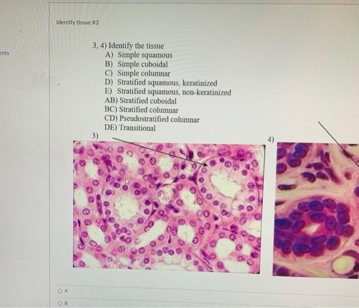 Ents Identify Tissue 3 Oa Ob 3 4 Identify The Tissue A Simple Squamous B Simple Cuboidal C Simple Columnar D Stra 1