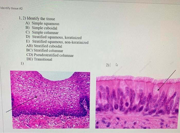 Ents Identify Tissue 3 Oa Ob 3 4 Identify The Tissue A Simple Squamous B Simple Cuboidal C Simple Columnar D Stra 2