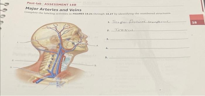 Post Lab Assessment 188 Major Arteries And Veins Complete The Labeling Activities In Figures 18 24 Through 18 27 By Iden 1