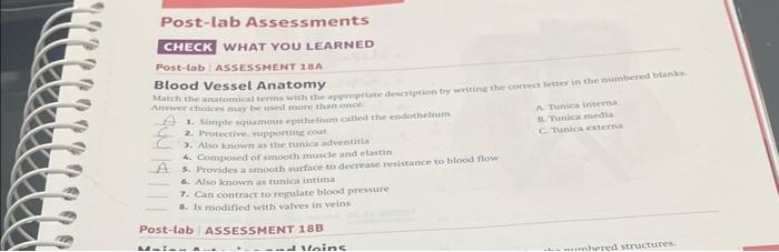 Post Lab Assessment 188 Major Arteries And Veins Complete The Labeling Activities In Figures 18 24 Through 18 27 By Iden 2