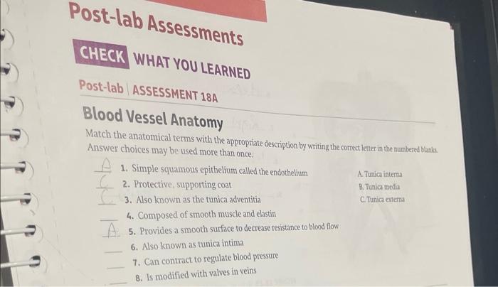Post Lab Assessment 188 Major Arteries And Veins Complete The Labeling Activities In Figures 18 24 Through 18 27 By Iden 3