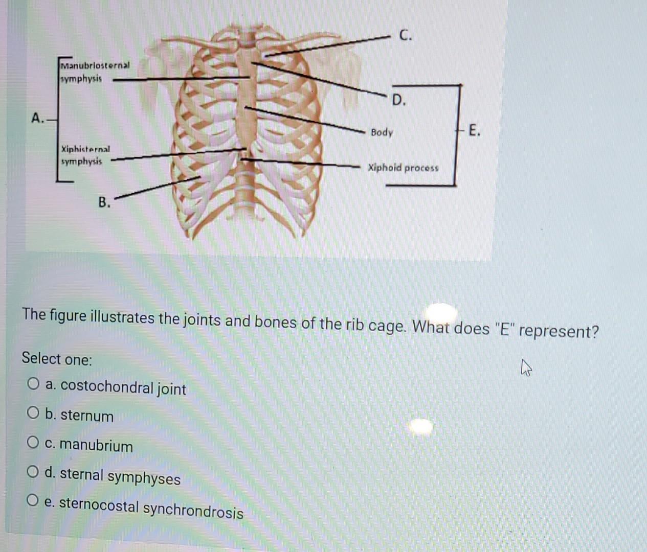 A Manubriosternal Symphysis Xiphisternal Symphysis B Bp Select One O A Costochondral Joint O B Sternum O C Manubr 1