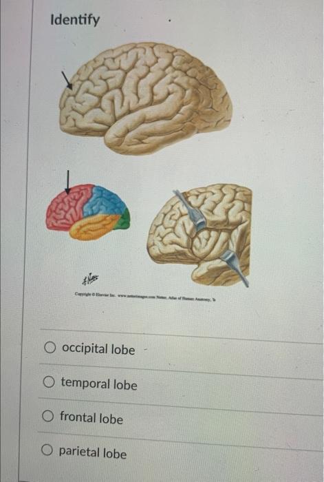Which Is Not A Function Of This Structure Coordination O Balance O Muscle Memory O Speech Identify Car Occipital Lobe 2