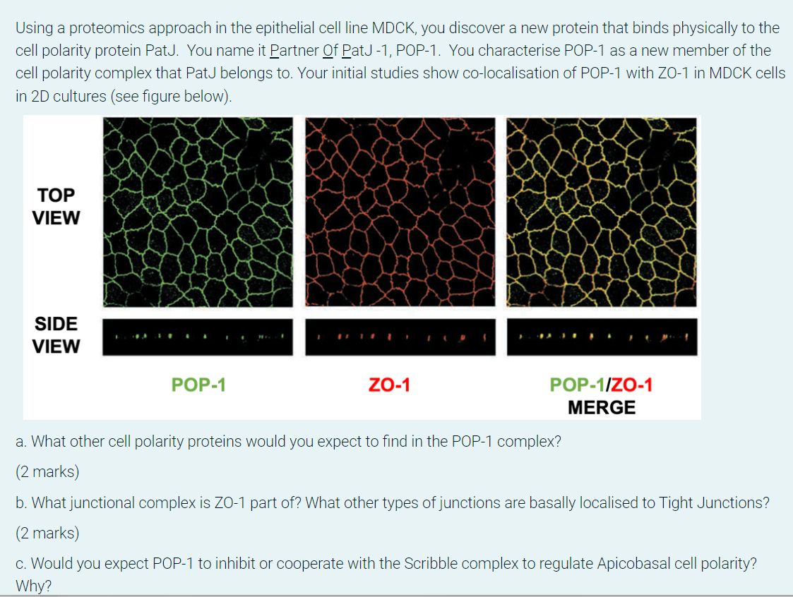 Using A Proteomics Approach In The Epithelial Cell Line Mdck You Discover A New Protein That Binds Physically To The Ce 1