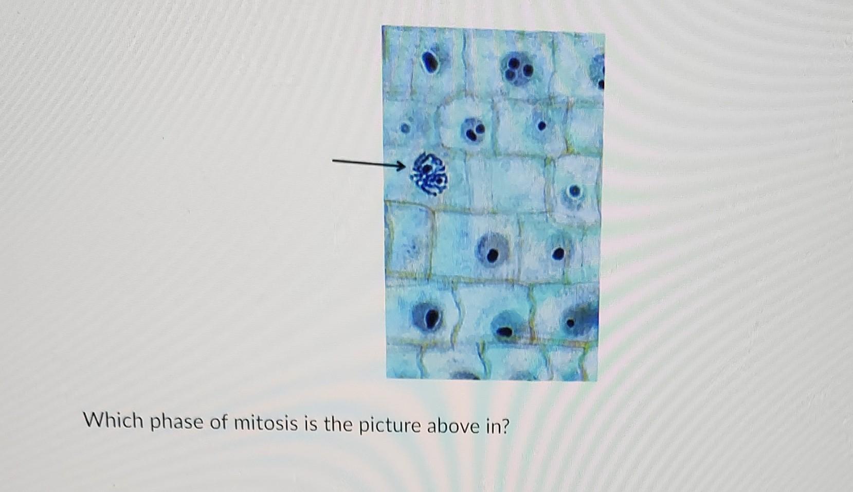 Which Phase Of Mitosis Is The Picture Above In 1