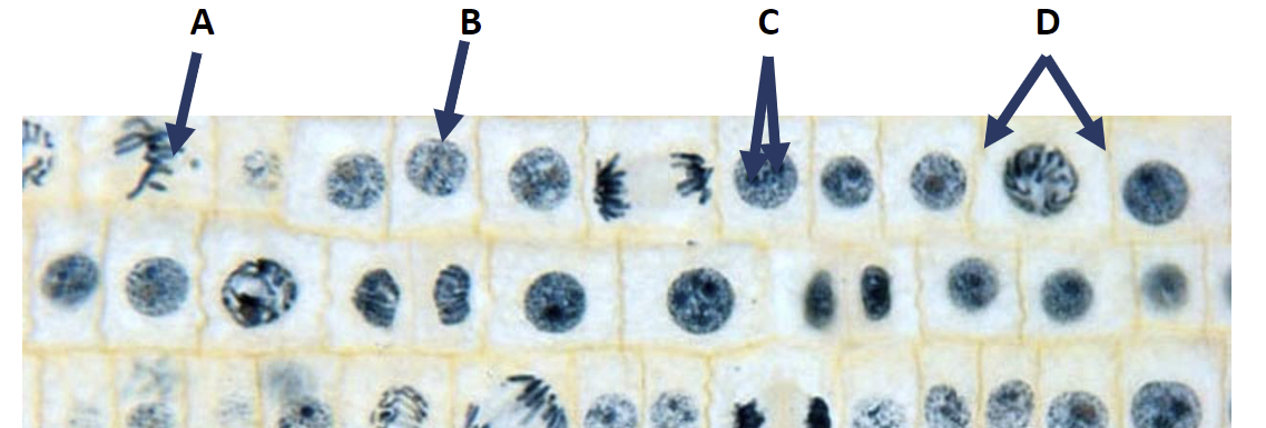 After You Observed The Microphotograph Of A Section Of Onion Root Tip In The Mitosis Lab Reading File Label The Structu 1