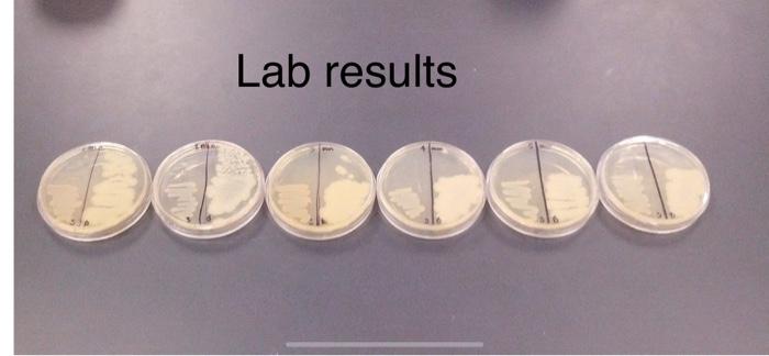 Box Or Shield To Cover Lamp 3 Nutrient Agar Plates Inoculating Loop Or Swab Bunsen Burner And Striker Procedure Pe 5