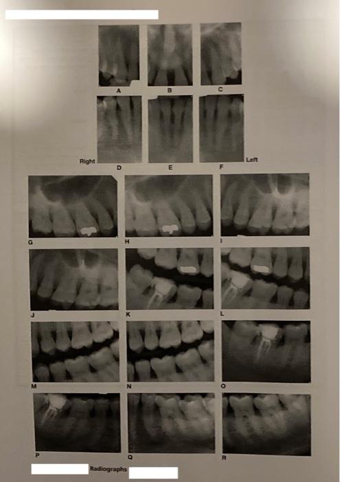 Right D Radiographs E Left R Maxillary Arch Lingual View Mandibular Arch Clinical Photographs Right Side Facial Vie 2