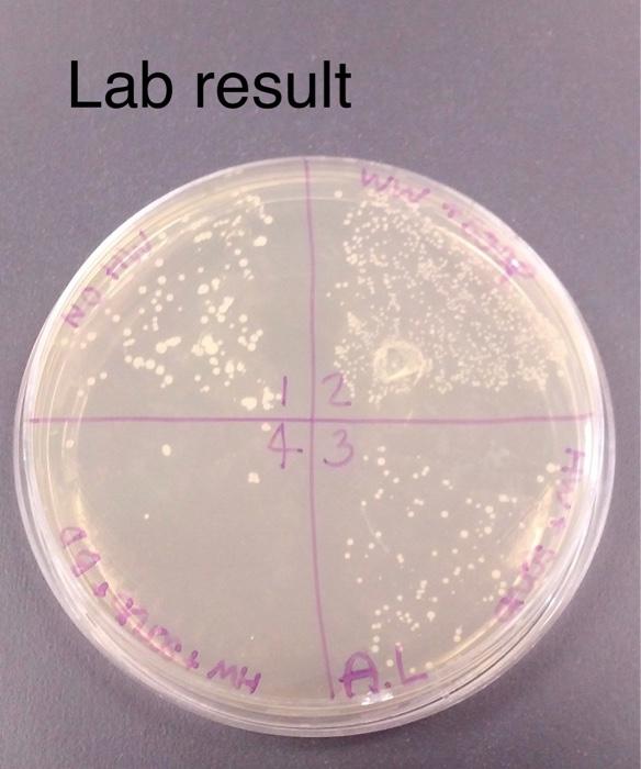 Results And Interpretation Plate 1 Is Unwashed Skin And Should Show Both Resident Normal Biota And Transient Organisms 2