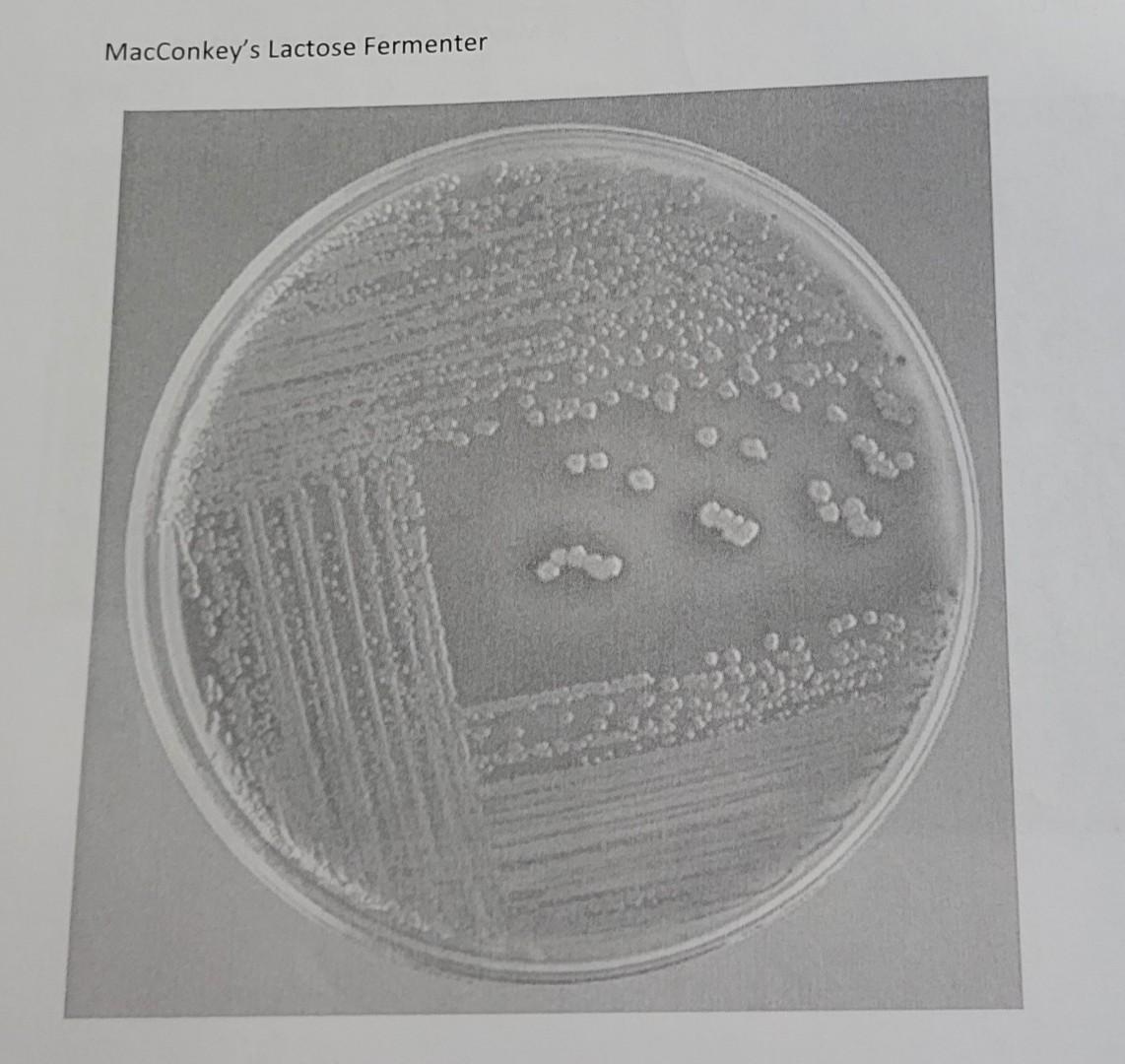 Question 2 You Are Microbiology Dept Today You Are Making Media One Of Your Tasks Today Is To Check Yesterday The Qua 4
