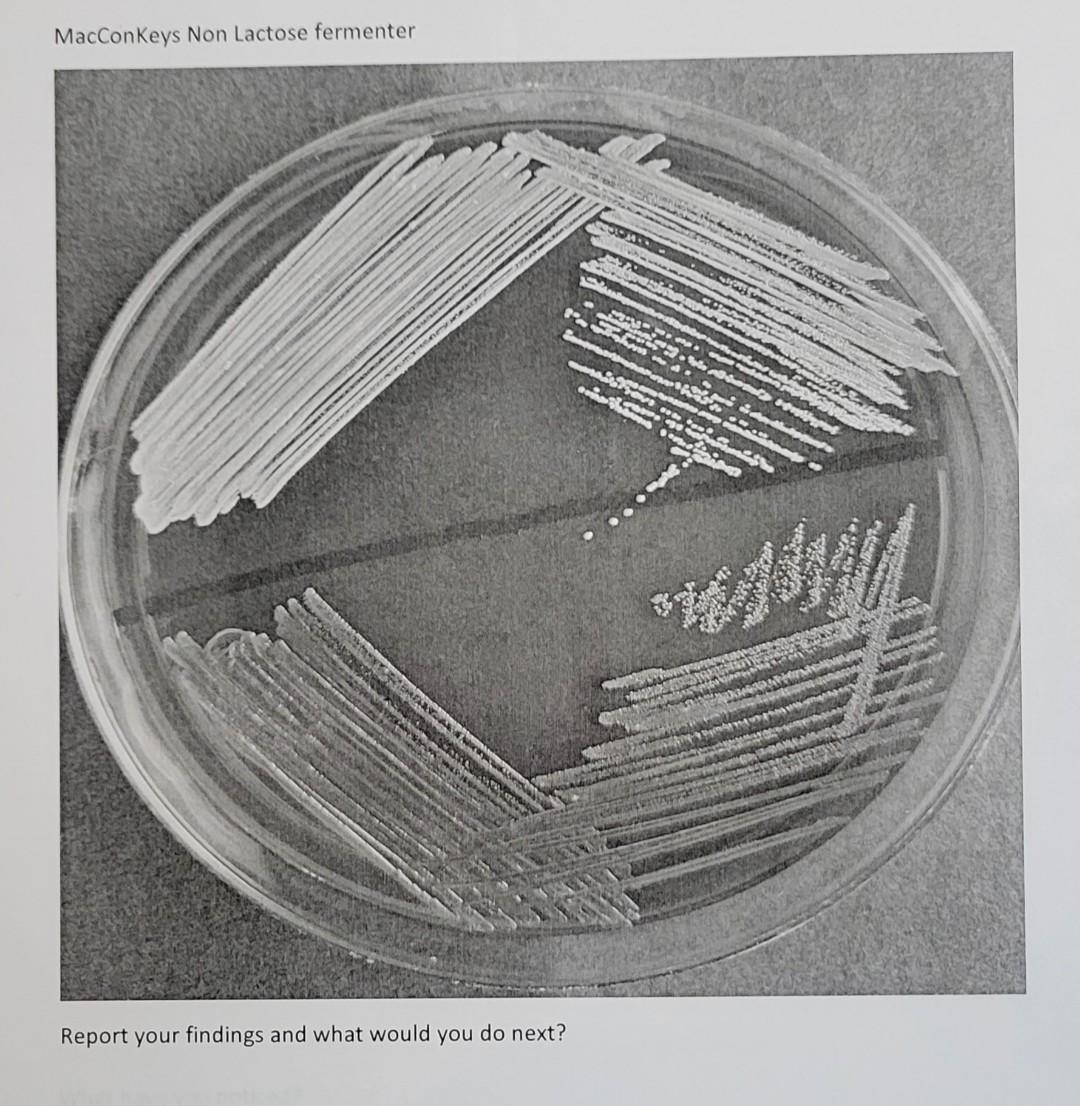Question 2 You Are Microbiology Dept Today You Are Making Media One Of Your Tasks Today Is To Check Yesterday The Qua 5