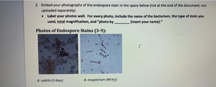 Capsule And Endospore Stain 3 8 And 3 9 4 Points Purpose You Completed Capsule Stains And Endospore Stains And Viewe 4