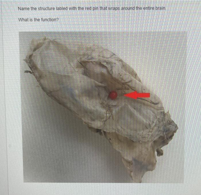 Name The Structure Labled With The Red Pin That Wraps Around The Entire Brain What Is The Function 1