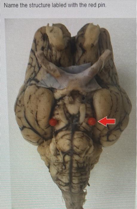 Name The Structure Labled With The Red Pin 1