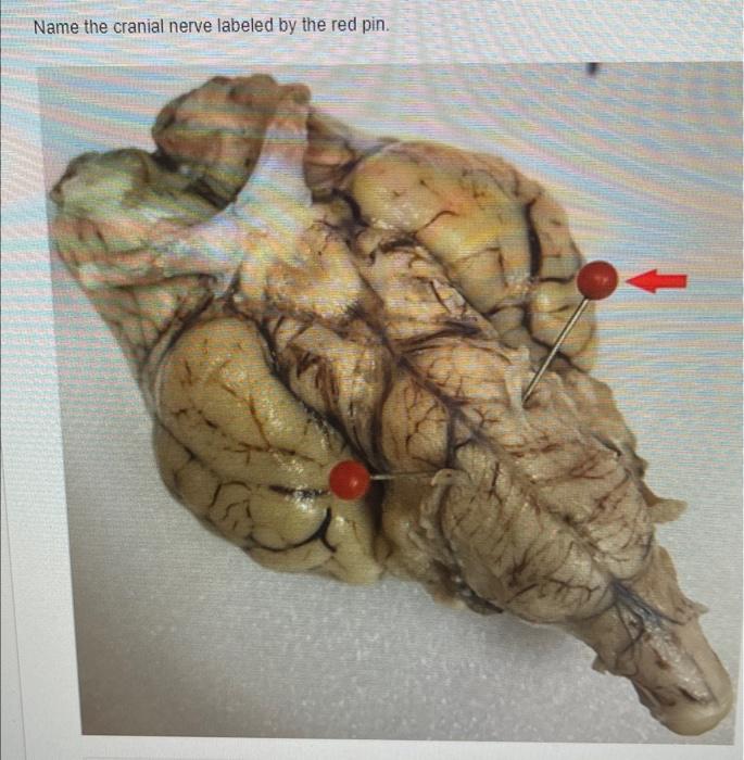 Name The Cranial Nerve Labeled By The Red Pin 1