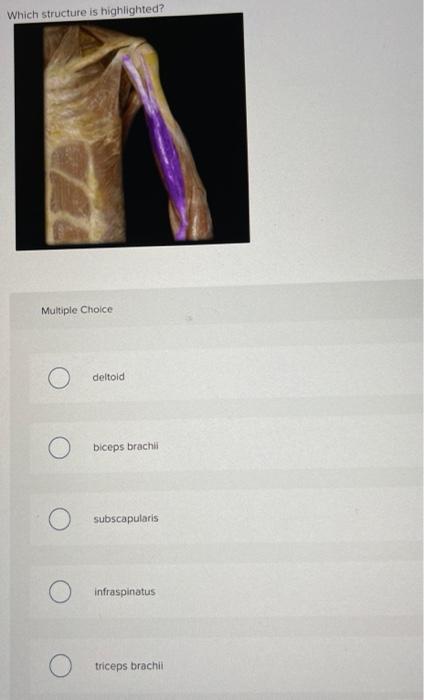 Which Structure Is Highlighted Multiple Choice O Deltoid Biceps Brachii Subscapularis Infraspinatus Triceps Brachil 1
