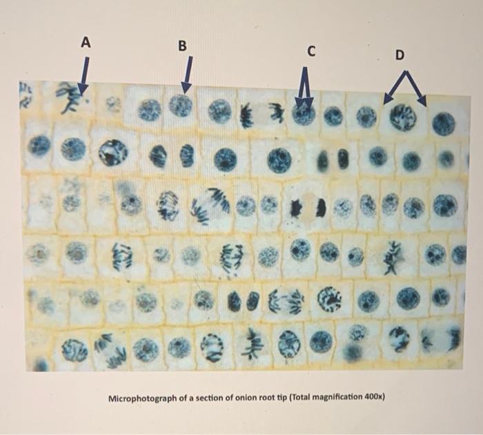 M A B Me C Microphotograph Of A Section Of Onion Root Tip Total Magnification 400x D 1