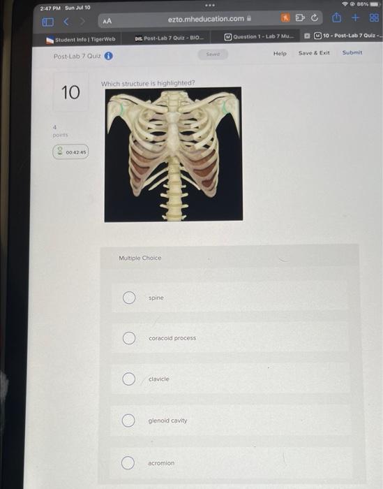 Which Structure Is Highlighted Multiple Choice O Scapula O Humerus Clavicle Glenoid Cavity Greater Tubercle Which Stru 12