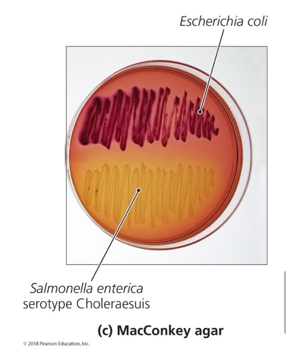 Ondon Salmonella Enterica Serotype Choleraesuis Escherichia Coli 2018 Pearson Education Inc Tom C Macconkey Agar 1