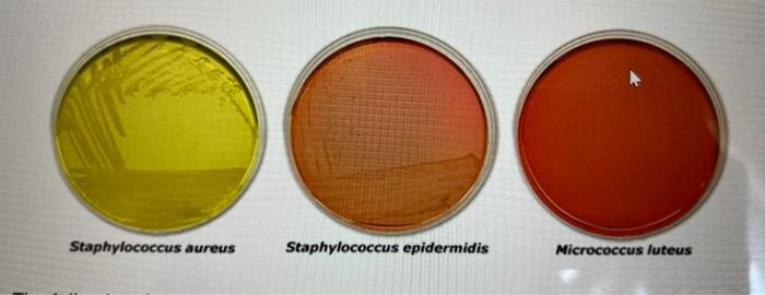 Staphylococcus Aureus Staphylococcus Epidermidis Micrococcus Luteus The Following Shows The Growth Of Several Bacteria 1