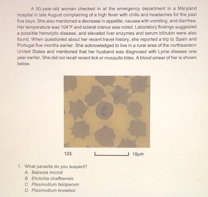 A 50 Year Old Woman Checked In At The Emergency Department In A Maryland Hospital In Late August Complaining Of A High F 1