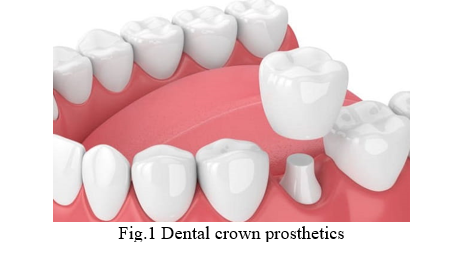 In Dentistry There Exist A Lot Of Needs Of High Strength And High Precision Dental Crowns Made Of Zirconia Fig 1 Illus 1