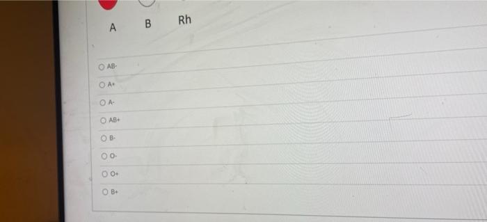 Name The Indicated Blood Type Shown Below The Dots Represent Agglutination While The Filled In Ovals Represent No Agglu 2