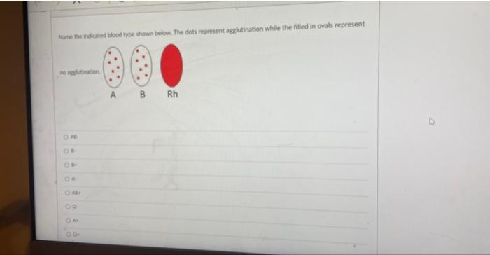 Name The Indicated Blood Type Shown Below The Dots Represent Agglutination While The Filled In Ovals Represent No Agglu 1