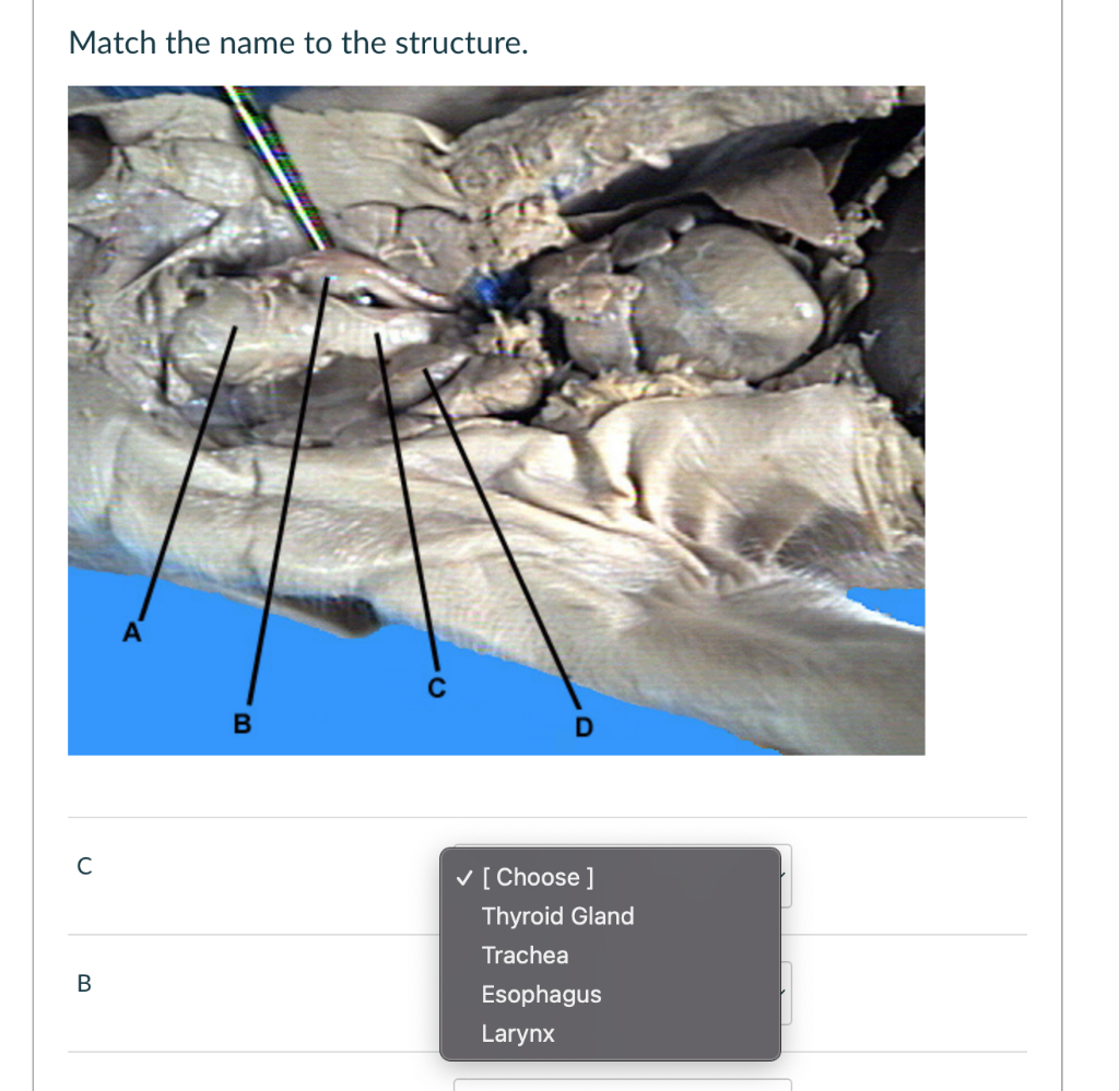Match The Name To The Structure C B A B D Choose Thyroid Gland Trachea Esophagus Larynx Question 23 Which Letter 1