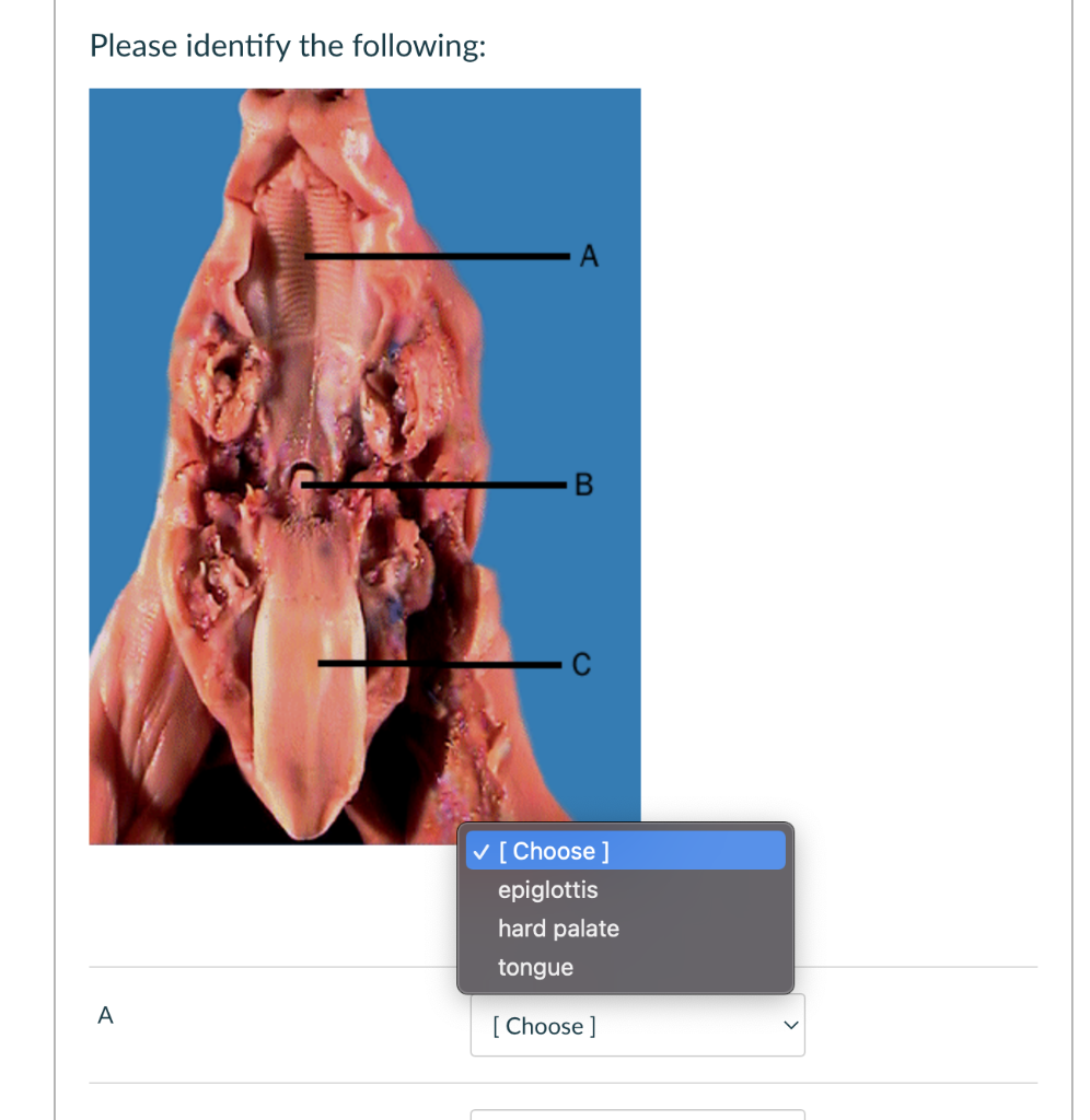 Please Identify The Following A B Choose Epiglottis Hard Palate Tongue Choose Identify The Following A B B 1