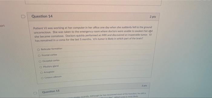 Question 1 Patient Lt Has Been Diagnosed With Schizophrenia Lt Frequently Hears Voices That Tell Him What To Do At Oth 14